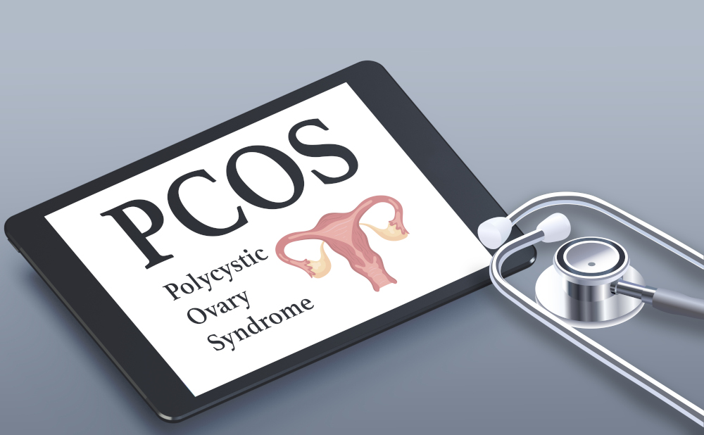 <h2 class="text-center style-1">Polycystic ovary syndrome</h2>